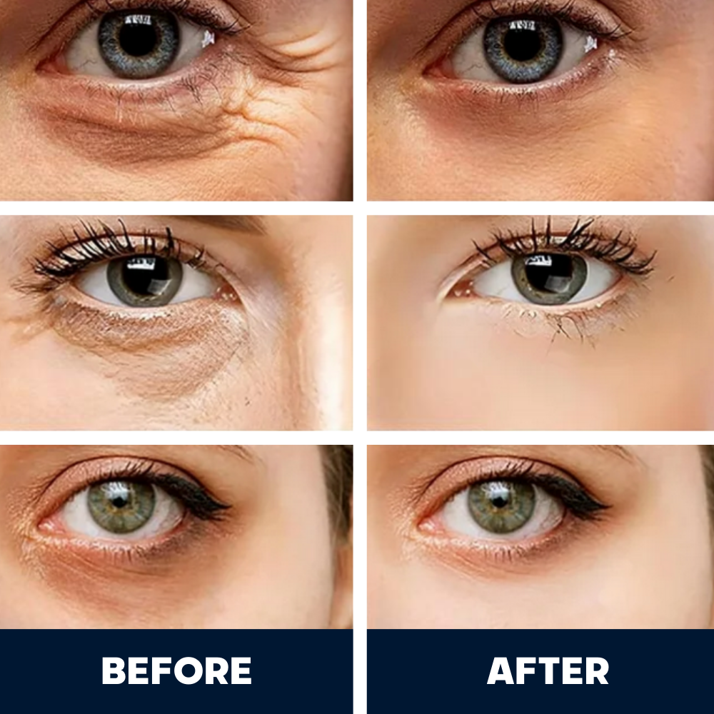 BrightEyes™ Caffeine Lift Cream – Clinically Inspired Care for Dark Circles, Puffiness & Wrinkles